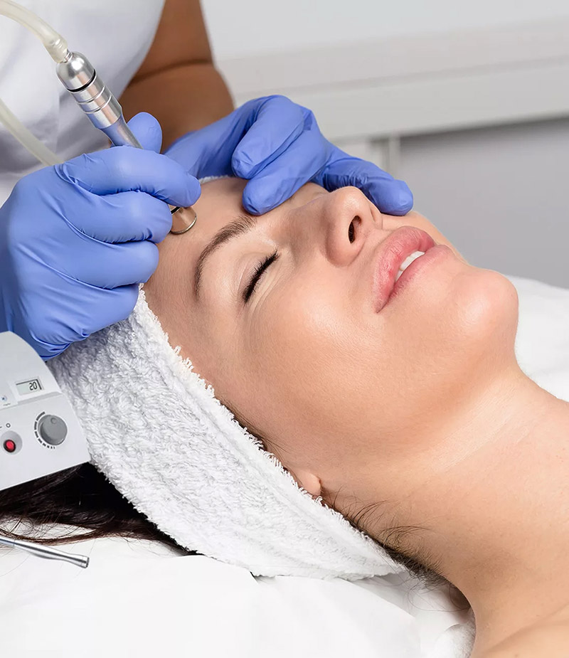 Microdermabrasion Image